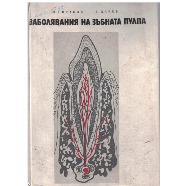 Заболявания на зъбната пулпа